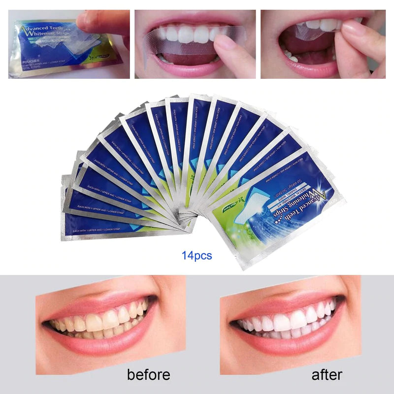 CINTA TIRAS BLANQUEADORA DENTAL. TU SONRISA DESTACA FRENTE A LOS DEMAS.
